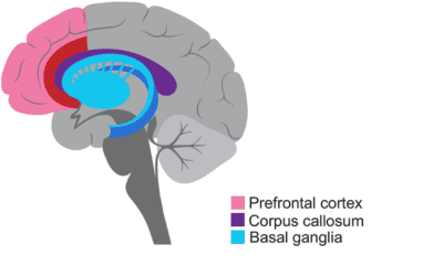 Understanding ADHD from a Neuropsychological Perspective